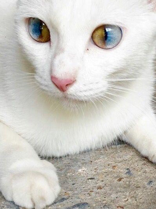 Unusual Type of Heterochromia