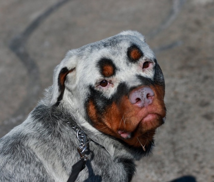 vitiligo