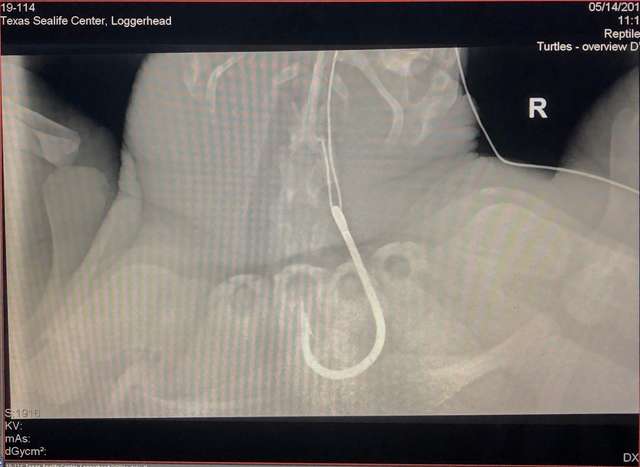 A Sea Turtle Eats a Large Fishing hook But Was Rescued