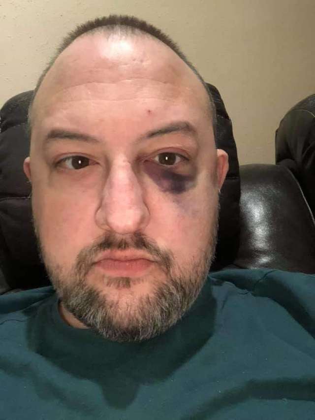 Rescued Pitbulls Stopped An Attempted Robbery To Save Their Owner's Life