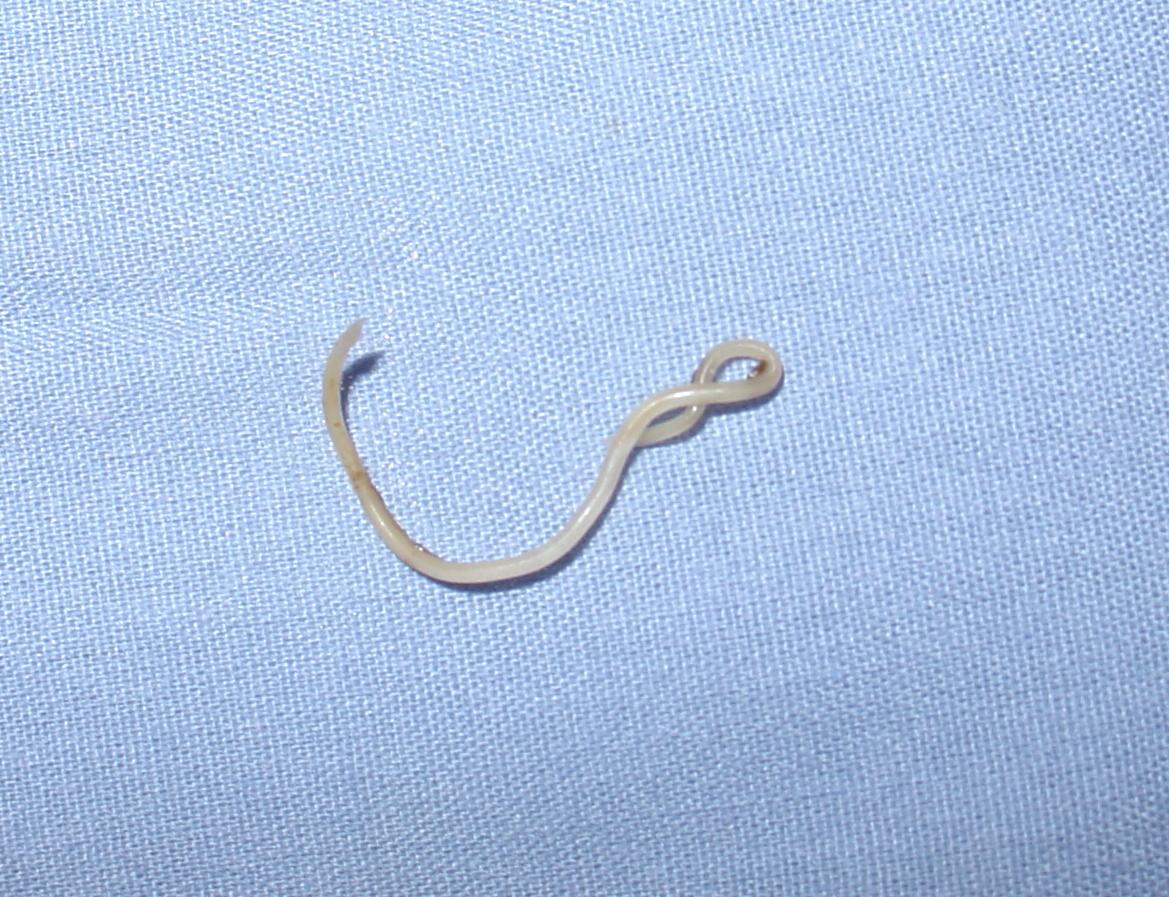 A canine roundworm passed by an infected dog