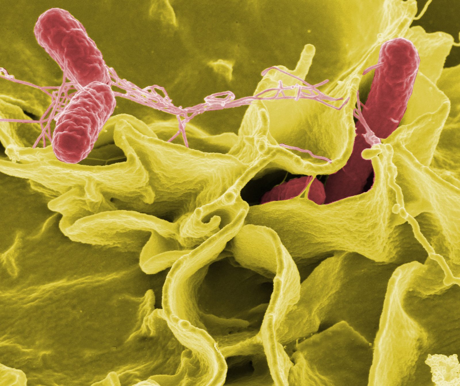 Colour enhanced electron microscope image of Salmonella bacteria invading cells
