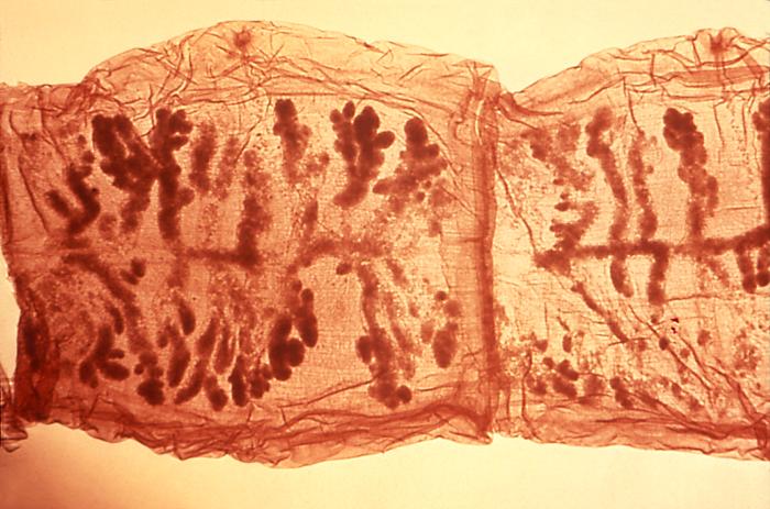 Tapeworm segments, called proglottids