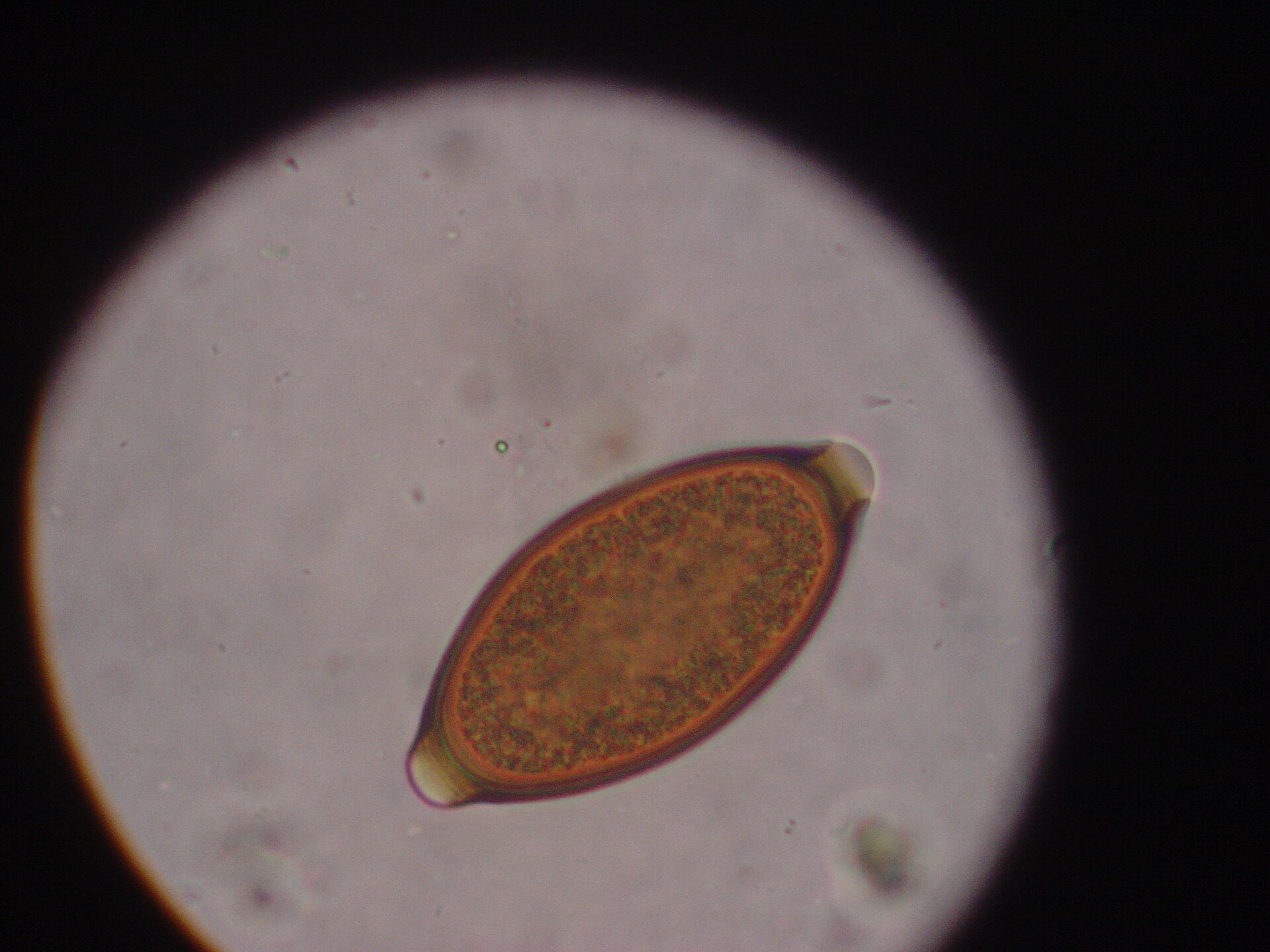 A whipworm egg under the microscope